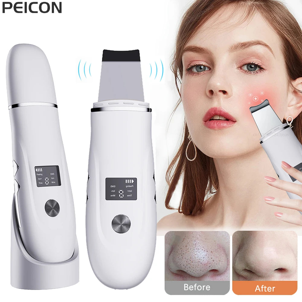 Ultrasonic Face Scrubber: Deep Cleansing Spatula for Acne & Pore Care | Skin Peeling & Facial Cleanser